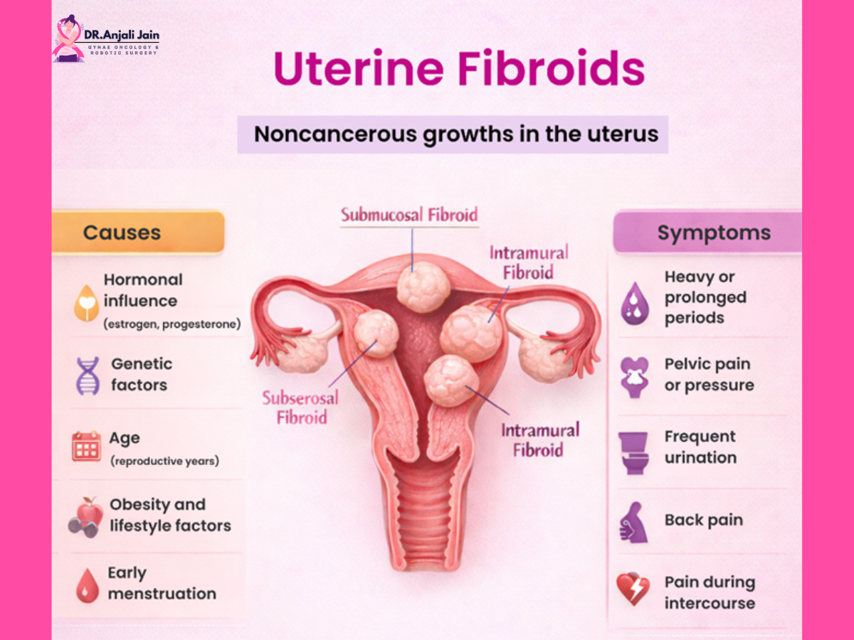 uterine-fibroids-treatment-gurugram